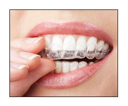 grincement des dents